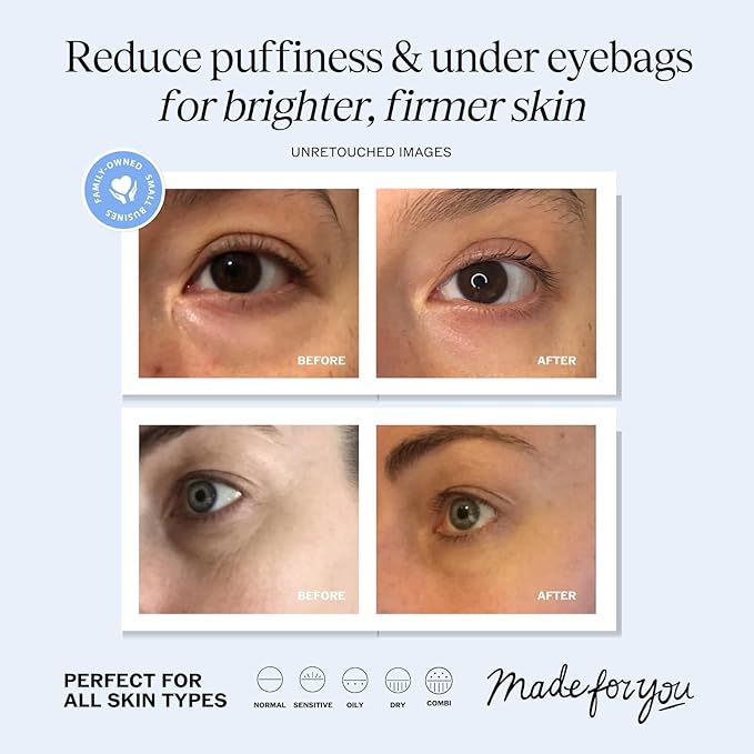Eye Cream for Dark Circles