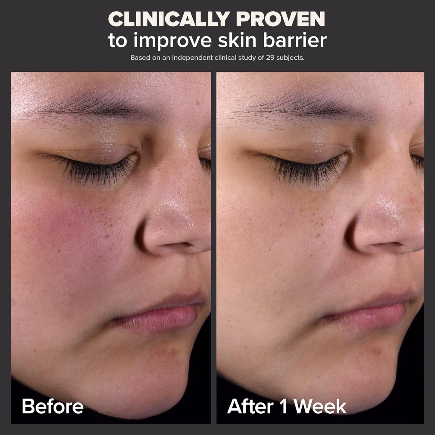 Paula's Choice SKIN PERFECTING